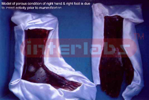 Insect activity on right hand and right foot prior to mummification